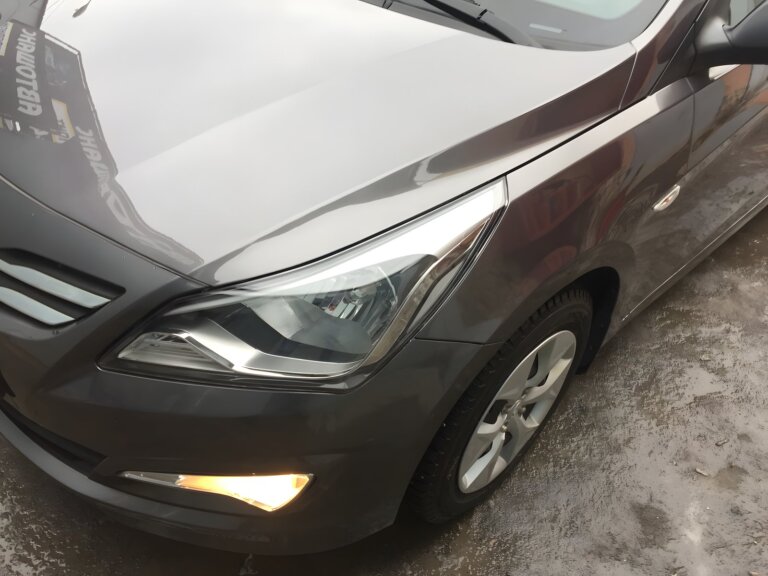 Hyundai Solaris: ремонт передней части после ДТП